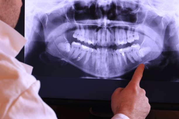 Best Emergency Broken Tooth Repair in Harrisburg, NC