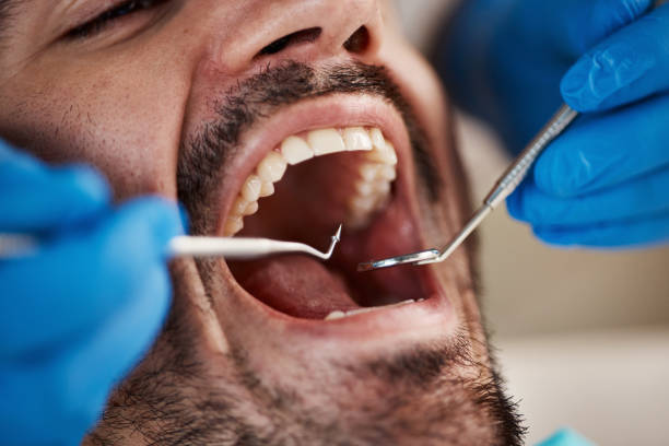 Best Emergency Dental Surgery in Harrisburg, NC