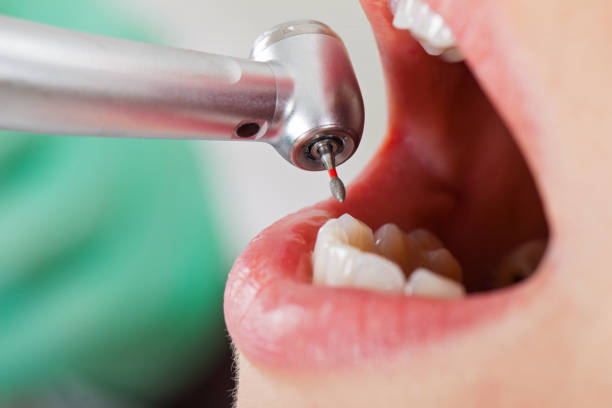 Best Emergency Dental Surgery in Harrisburg, NC